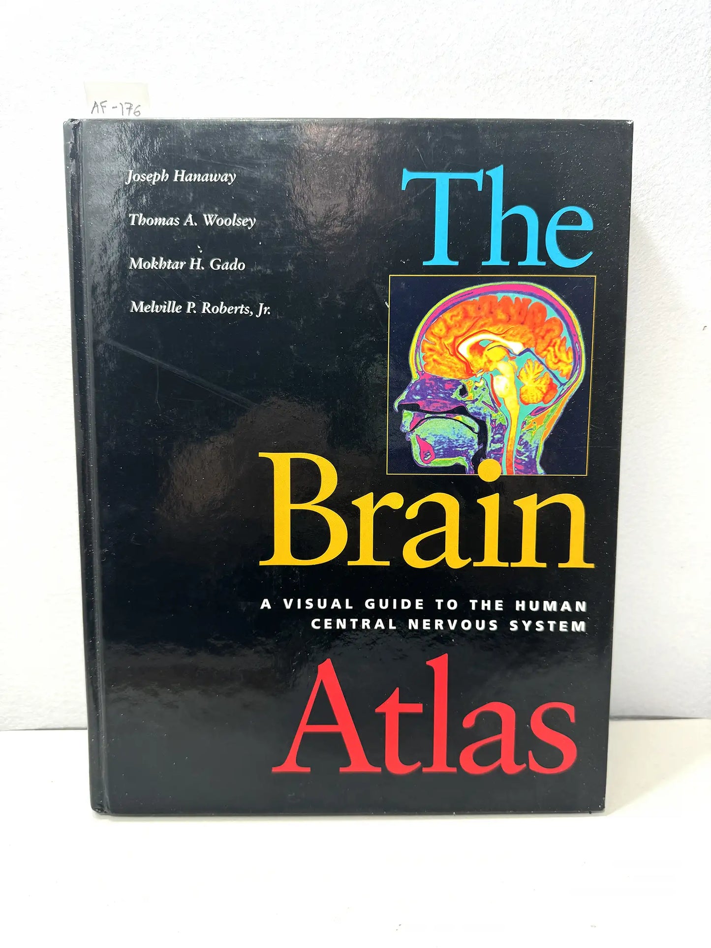 The Brain Atlas.